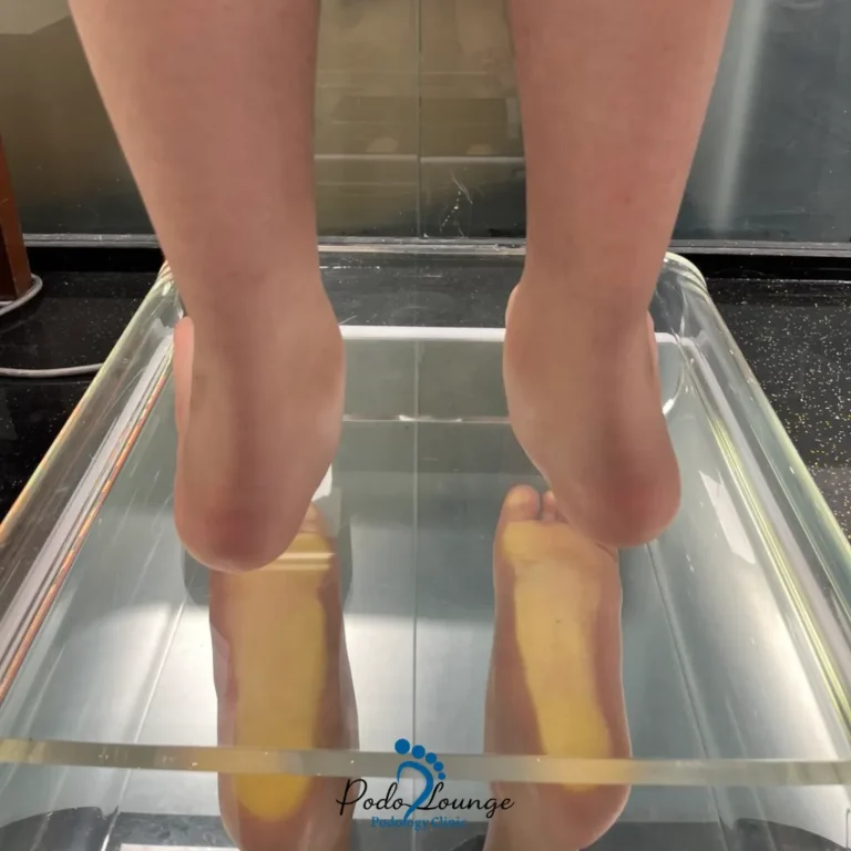 اسکن کف پا-پُدولانژ