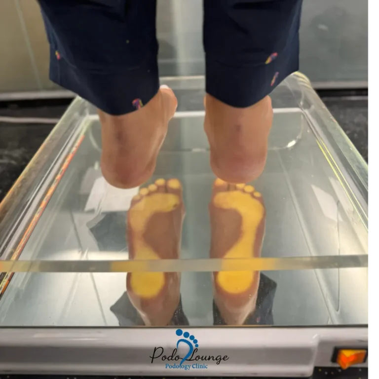 اسکن کف پا-پُدولانژ