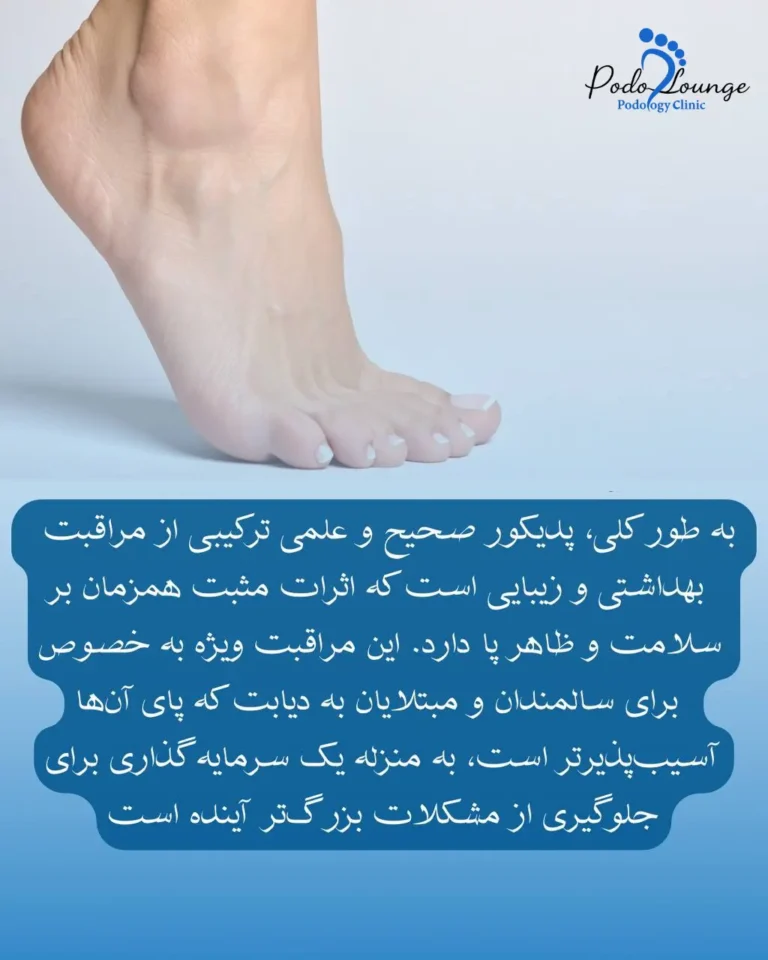 پدیکور درمانی در پدولانژ