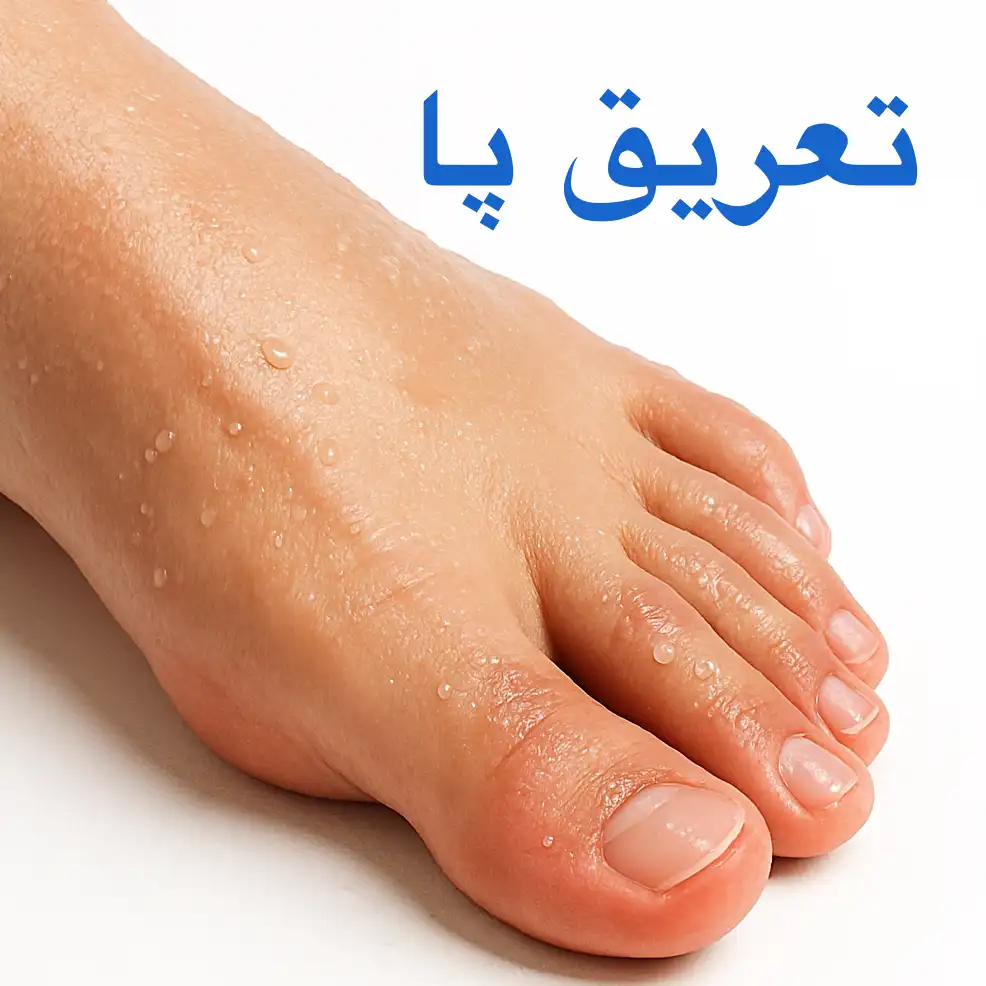 کفش برفوت | پُدولانژ